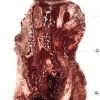et-10